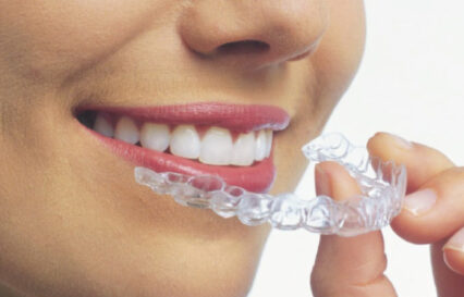 invisalign