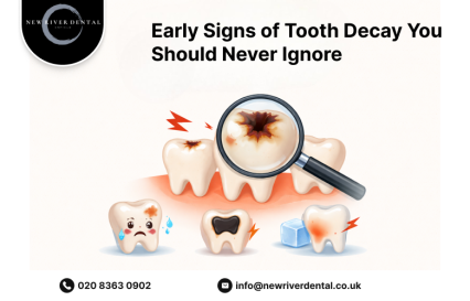 Early Signs of Tooth Decay You Should Never Ignore