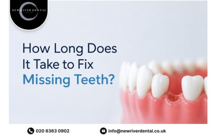 How Long Does It Take to Fix Missing Teeth?