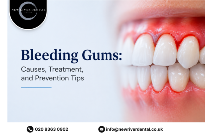 Bleeding Gums: Causes, Treatment, and Prevention Tips