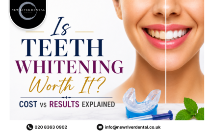 Is Teeth Whitening Worth It? Cost vs Results Explained