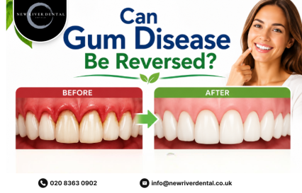 Can Gum Disease Be Reversed?