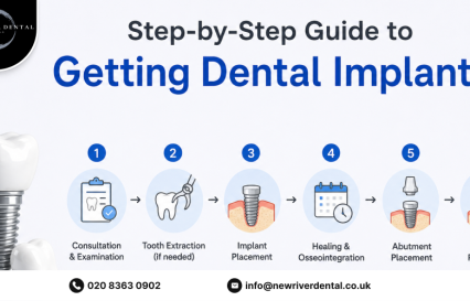 Dental Implant Procedure: Step-by-Step Guide