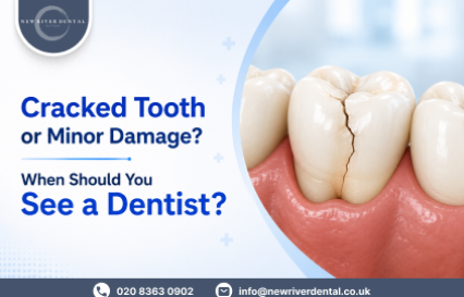 Cracked Tooth or Minor Damage? When to See a Dentist